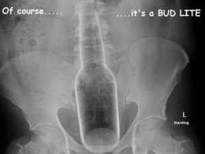 Stupid Bar Memes 763874f6b0d6bf09