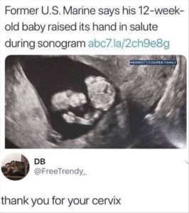 Stupid Bar Memes youreswantingskidss1